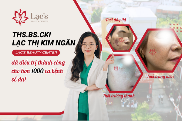 Bác Sĩ Ngân đã cùng Lạc’s Beauty Center điều trị thành công cho hơn 1000 ca bệnh về da!