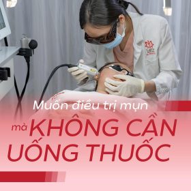 Laser FlexSys giúp điều trị mụn mà không muốn uống thuốc