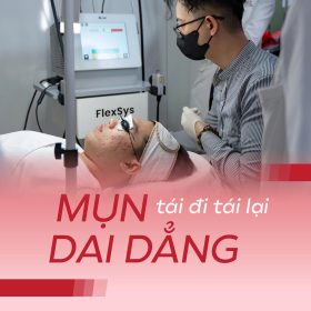 Laser FlexSys điều trị tình trạng mụn dai dẵn tái đi tái lại